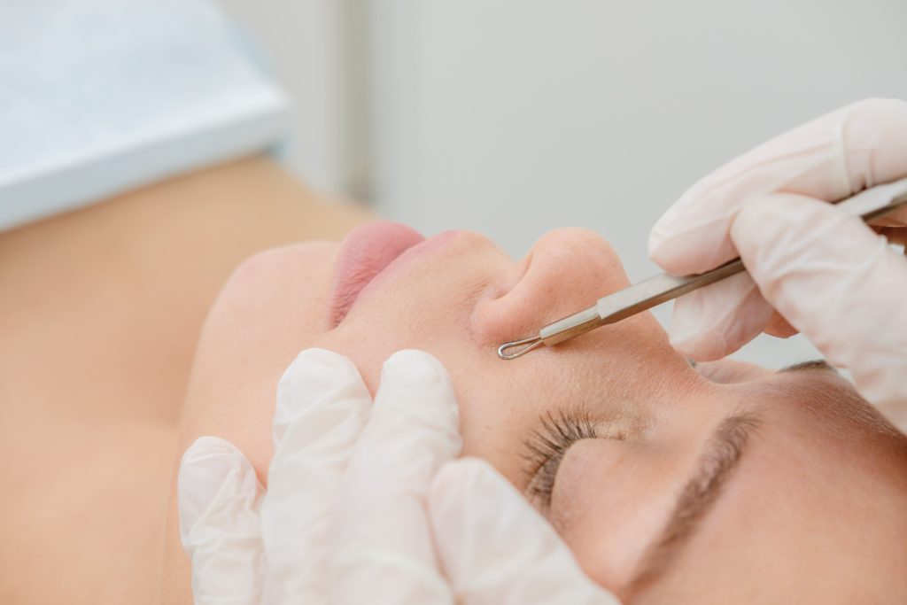 Portfolio 12 The doctor treating a woman's face | Get treatment for Acne Scars in A Nu U Aesthetics at Congers, New York